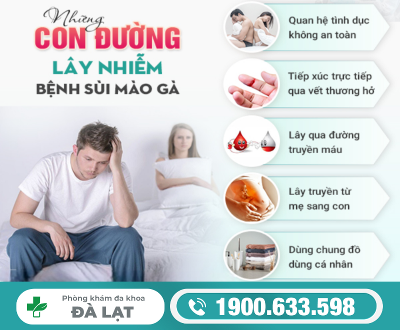 Hình ảnh minh họa